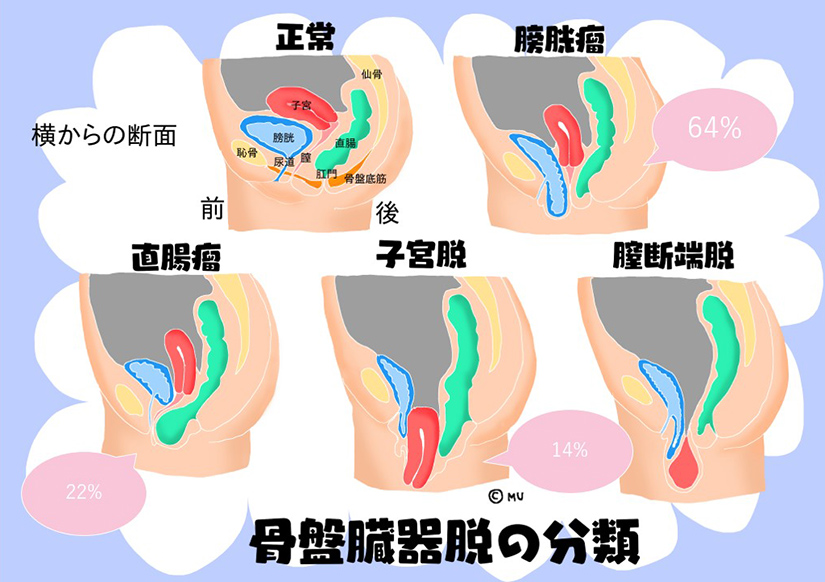 子宮 降り て くる