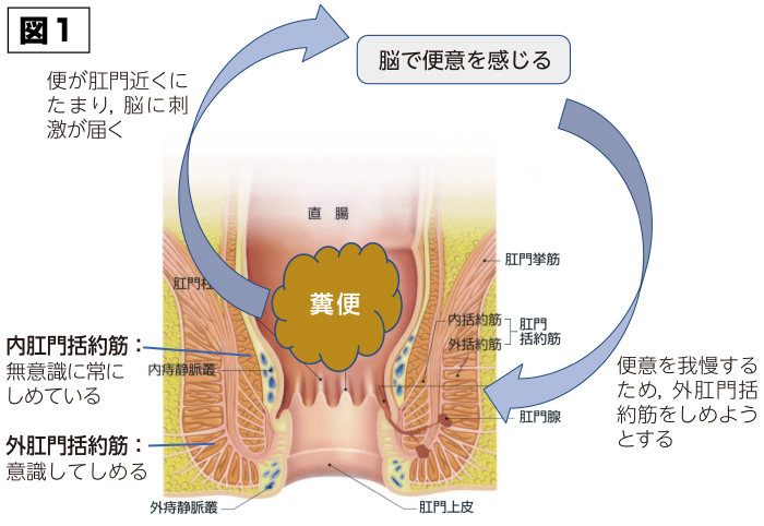 括約筋 男性の尿もれ治療「人工尿道括約筋埋め込み術」で排尿を ...