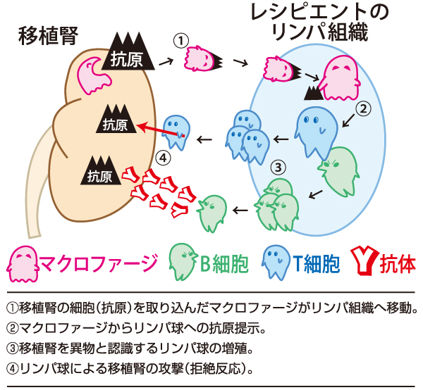 腎移植）腎移植と免疫 | 亀田グループサイト