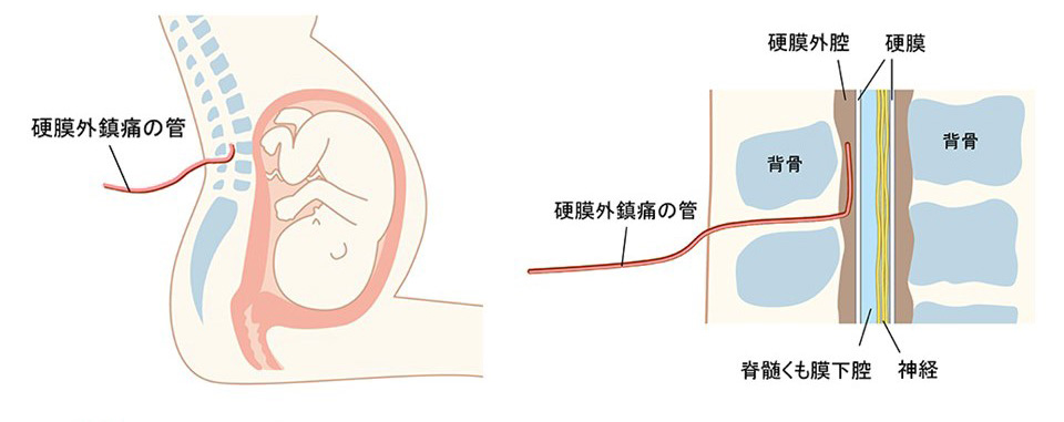 日本産科麻酔学会ホームページより引用