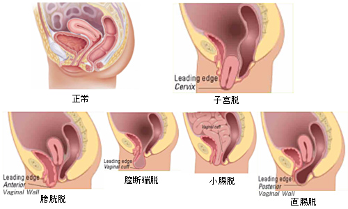 ウロギネ・女性排尿機能センター | 亀田総合病院