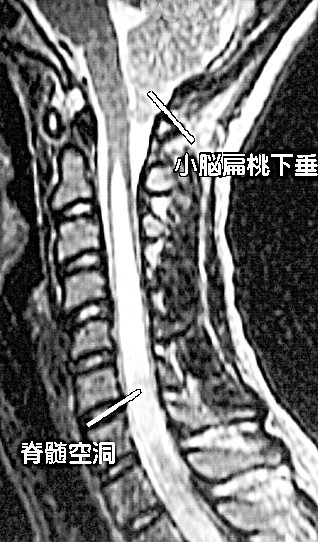 m3電子書籍 | 脊椎脊髄ジャーナル34巻11号(特大号) 成人脊柱変形