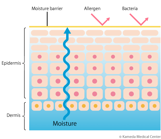 lymphedema11_1.jpg