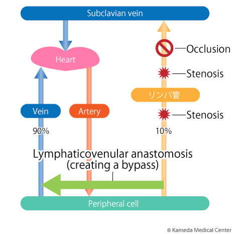 lymphedema7_2.jpg