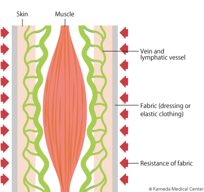 lymphedema9_2.jpg