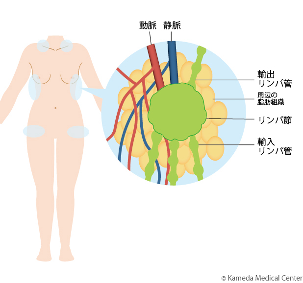 lymphedema8_01.jpg