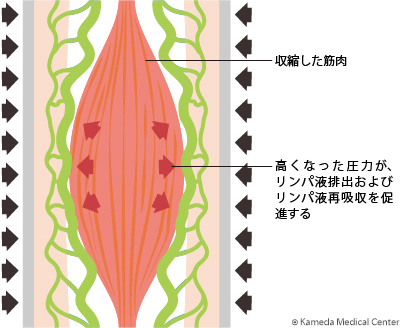 lymphedema9_01.jpg