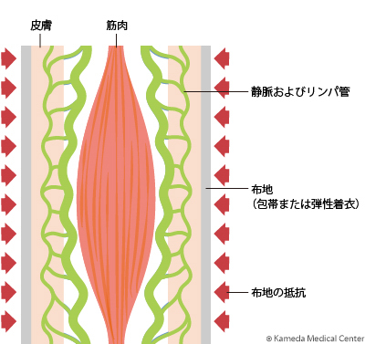 lymphedema9_02.jpg