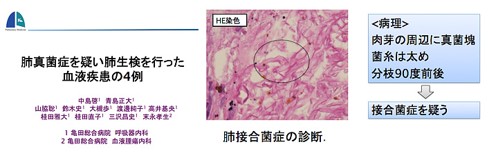 千葉真菌症カンファレンスで発表